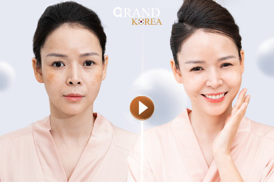 Thẩm mỹ viện Grand Korea loại bỏ vĩnh viễn các vết nám, tàn nhang bằng công nghệ Mega AI Collagen 6D