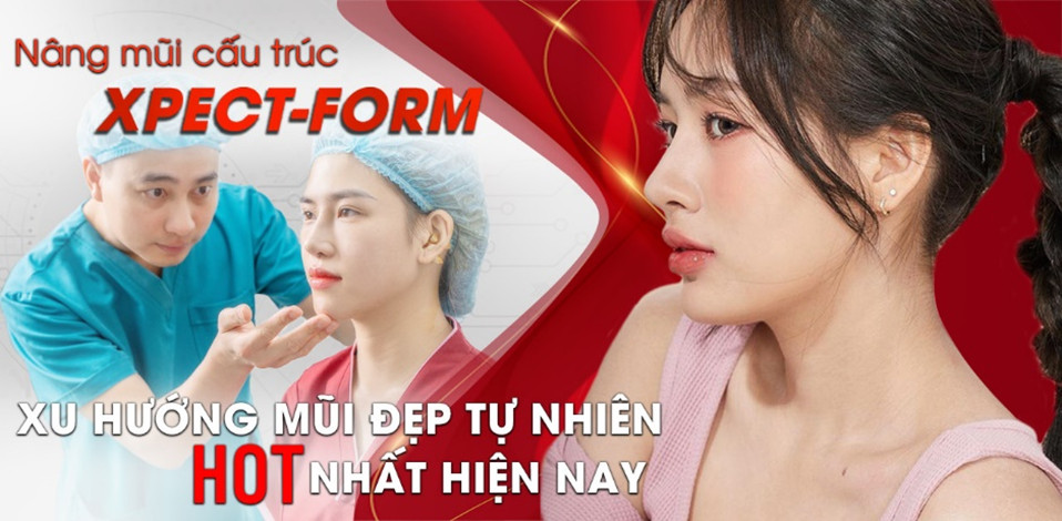 Nâng mũi cấu trúc XPECT-FORM xu hướng mũi đẹp tự nhiên hot nhất hiện nay